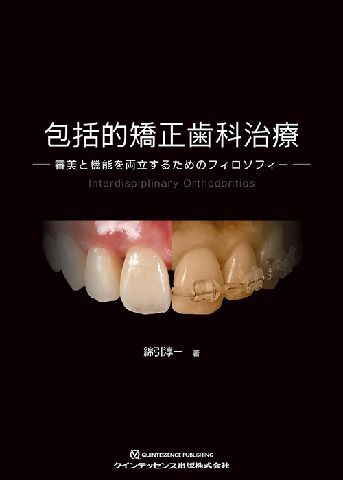 無理しない　無駄にしない　矯正歯科治療13の視点と実践例 無理しない」「無駄にしない」矯正歯科治療13の視点と実践例