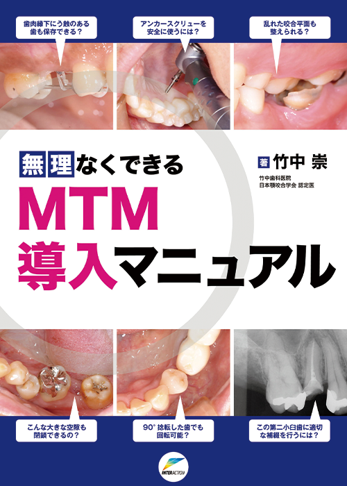 無理なくできるMTM導入マニュアル
