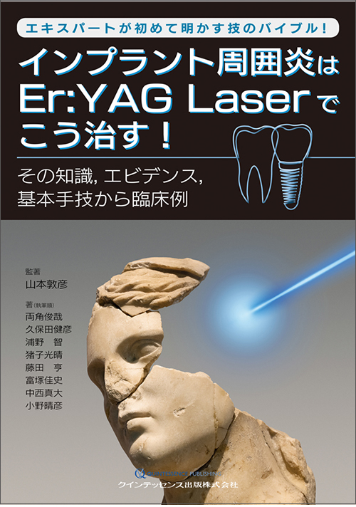 インプラント周囲炎はEr:YAG Laserでこう治す！